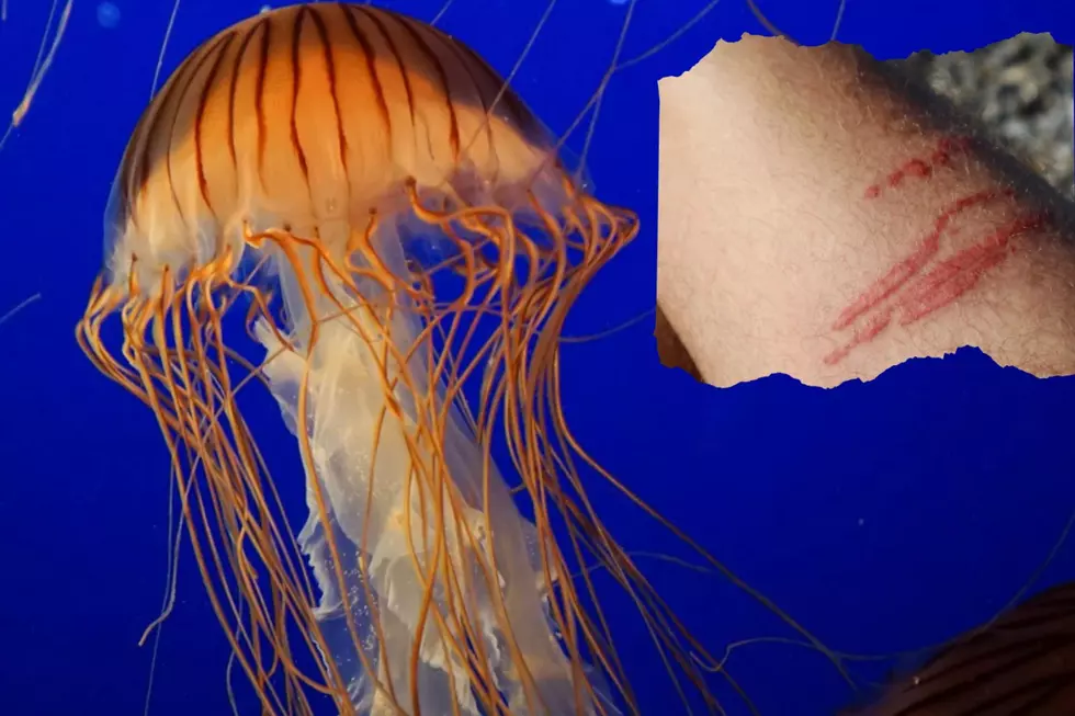 Stung By a Maine Jellyfish? DON’T PEE ON IT! Here’s Why